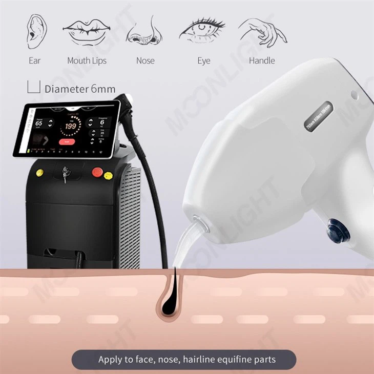 Most Popular Diode Laser Hair Removal Machine