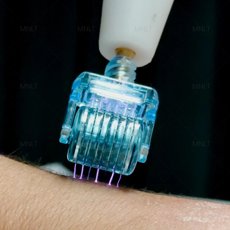 Hot & Cold Plasma Machine – Next-Gen Skin Rejuvenation Technology price