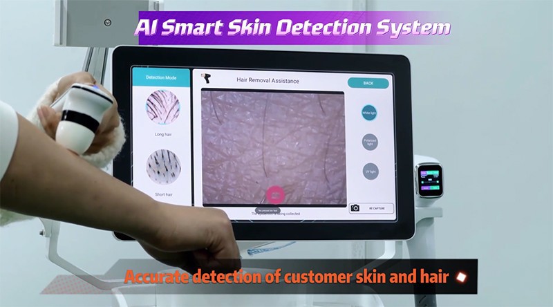 Laser Hair Removal Machine Easy Operation