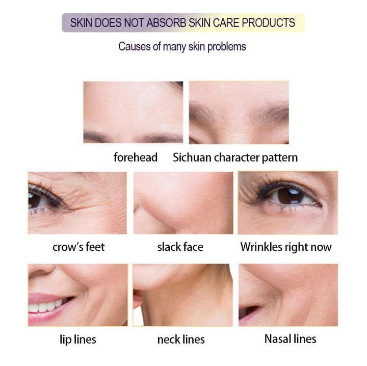 Medical Fractional CO2 Laser System