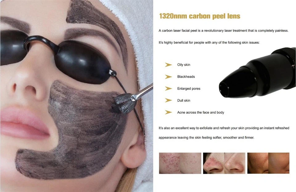 Portable Tattoo Removal Machine