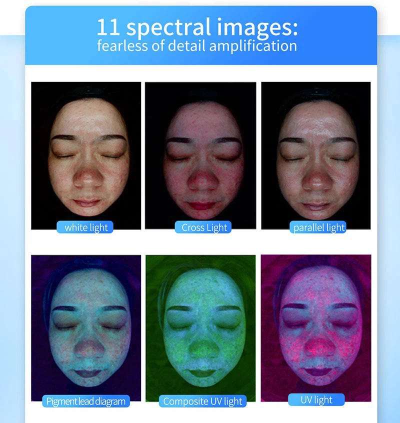 Skin Image Analyzer