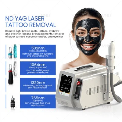 Mesin laser nd yag